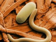 Habitat of roundworms